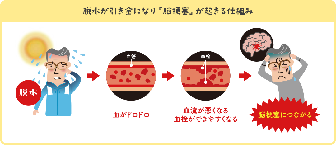 脱水が引き金になり「脳梗塞」が起きる仕組み